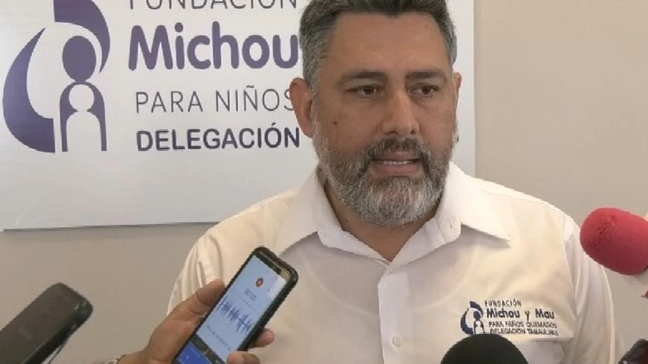 Atiende Fundación Michou y Mau a 45 niños con quemaduras graves