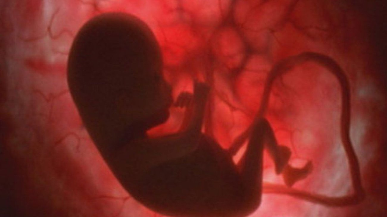 Doctor del IMSS deja feto muerto dentro de mujer por 4 días