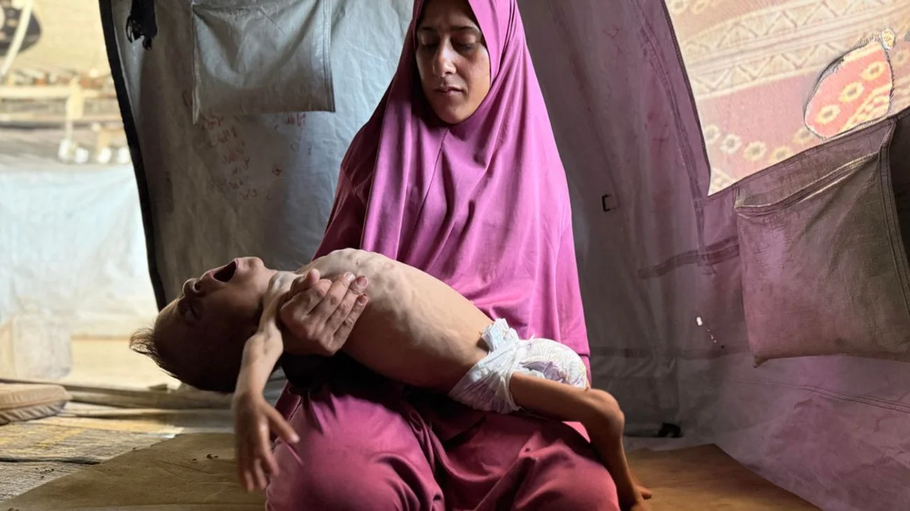 Desnutrición en Gaza: mueren cinco, un bebe y 2 niños en 24 horas