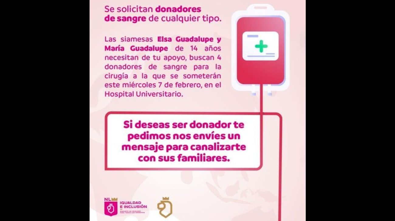 Secretaría de Igualdad se une a pedir apoyo para siamesas