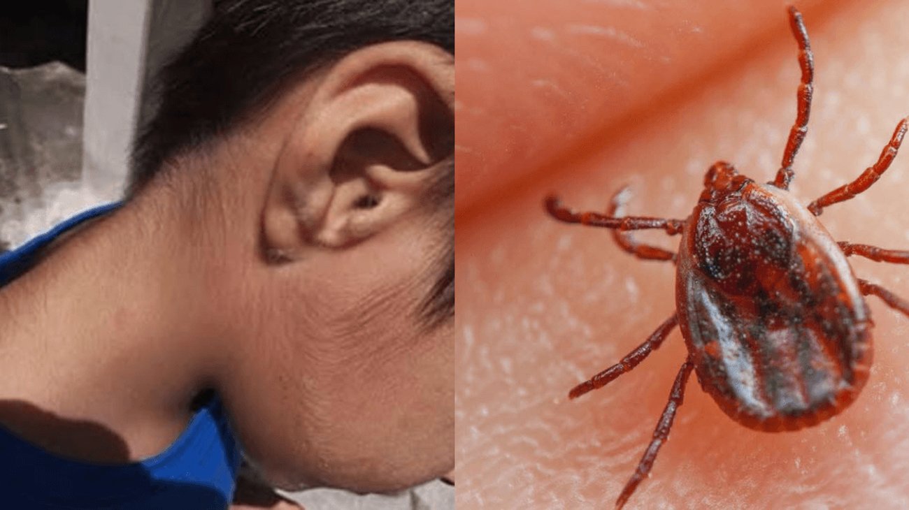 Refuerzan acciones ante plagas y enfermedades estacionales