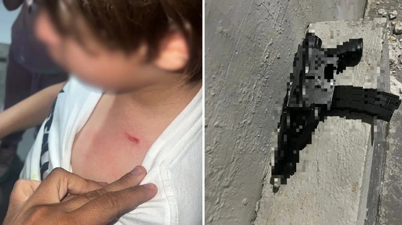 Madre exige justicia por ataque con postas y acusa encubrimiento