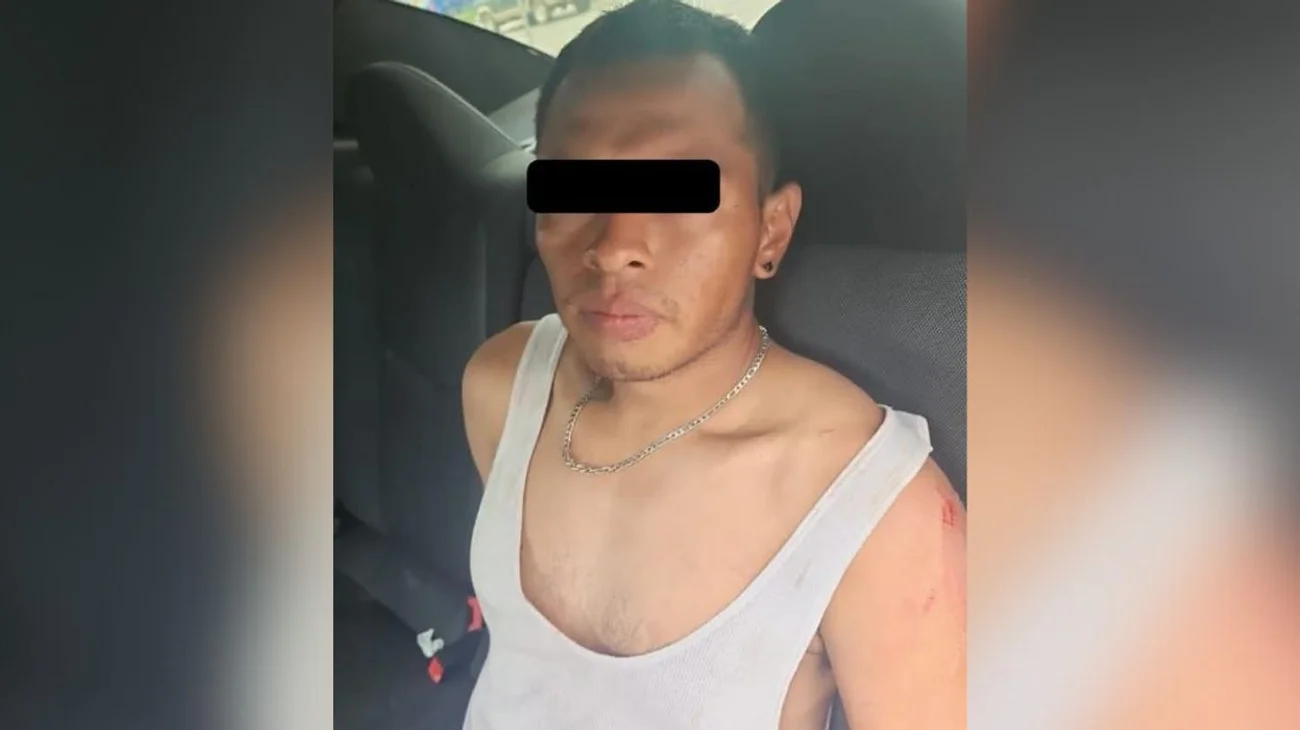 Muere joven quemado tras agonía de casi tres semanas