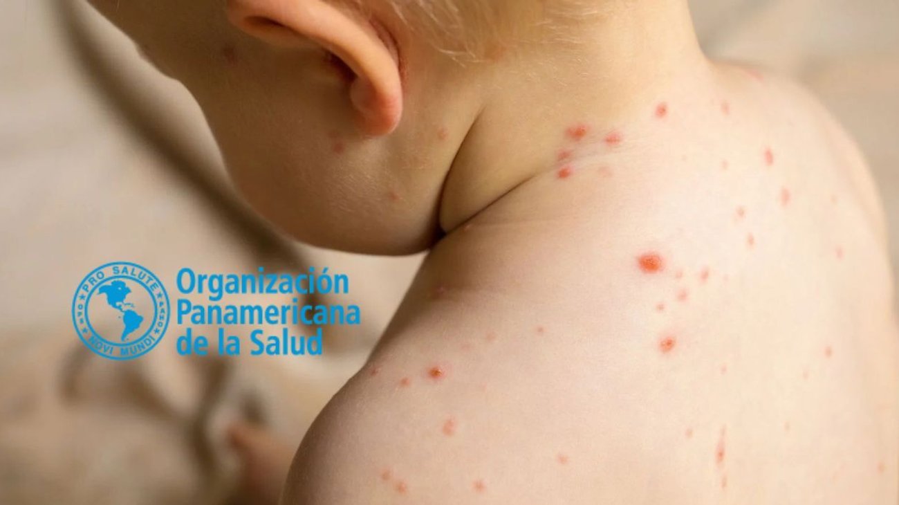 EH_UNA_FOTO_2026_02_04_T115042_922_52cf165416