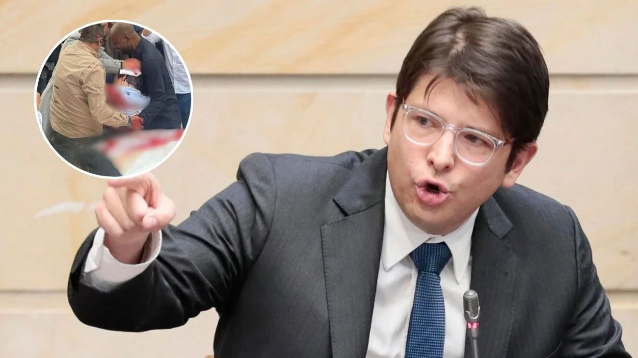 Balean a Miguel Uribe Turbay, aspirante presidencial de Colombia