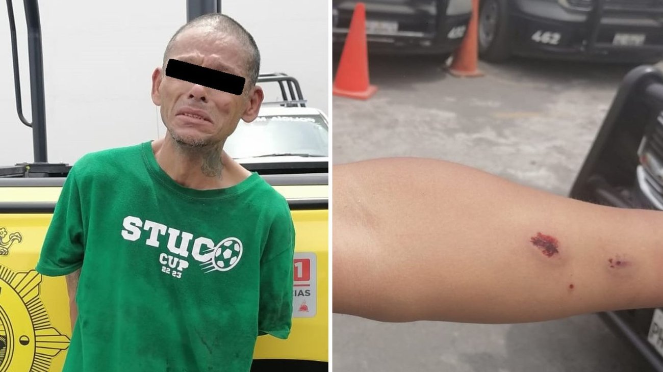 Ataca a mordidas a policías de Monterrey tras ser detenido