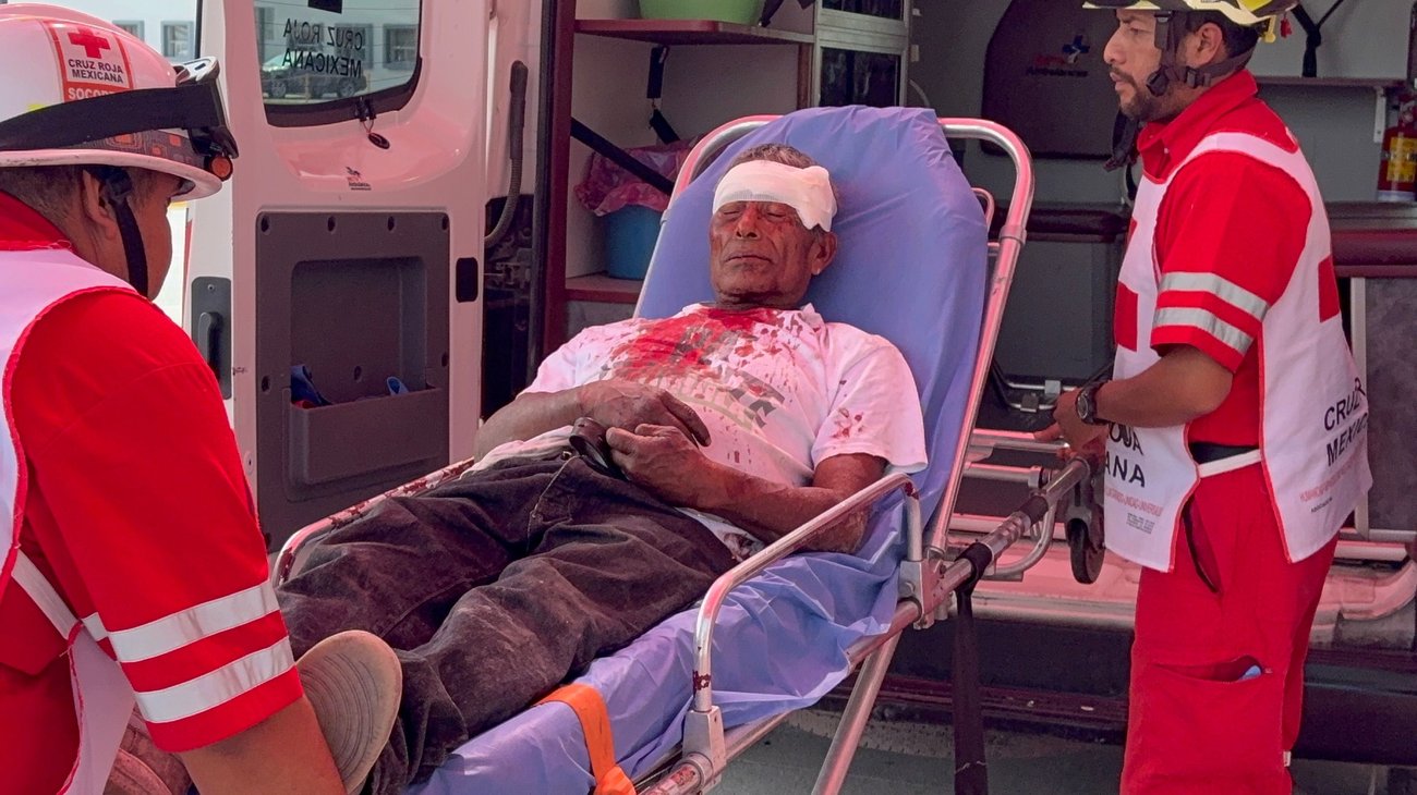 Golpean y asaltan a hombre de 65 años en la Avícola