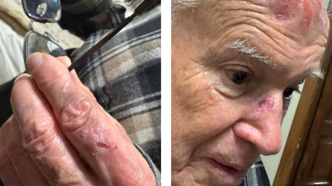 Obispo Emérito sufre nueva caída en el Centro de Saltillo