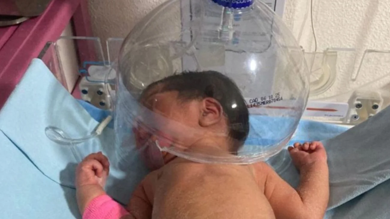 Indignante usan garrafón para dar oxígeno a bebé en Tabasco