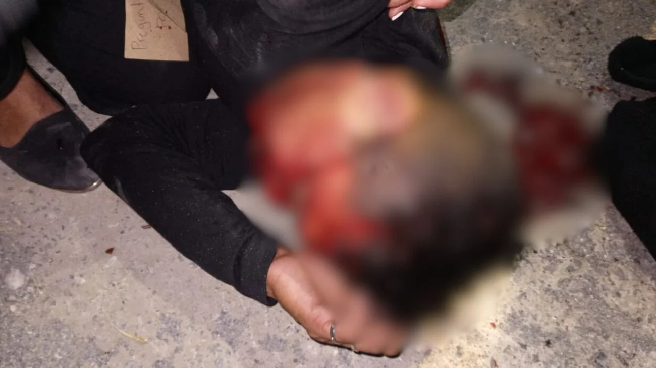 Policía Municipal de Saltillo detiene a dos hombres por lesiones