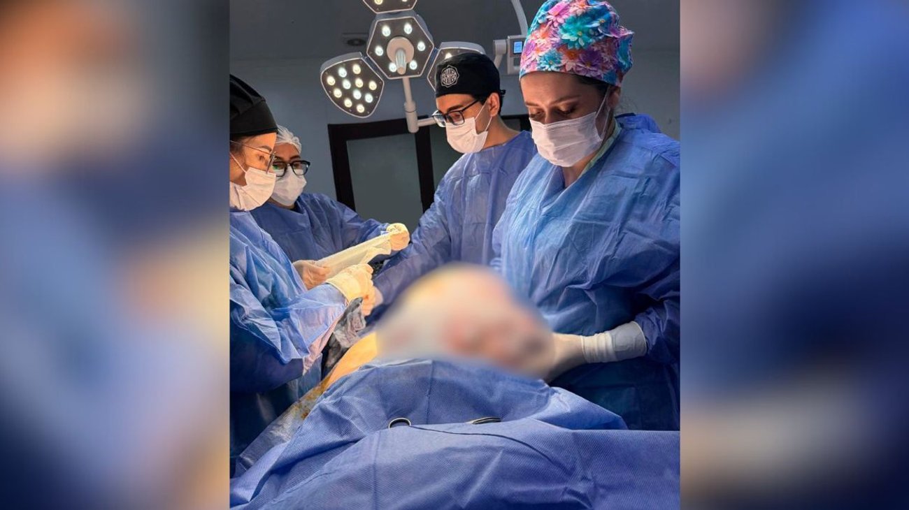 Médicos extirpan un tumor ovárico de 11 kilos en Paraguay