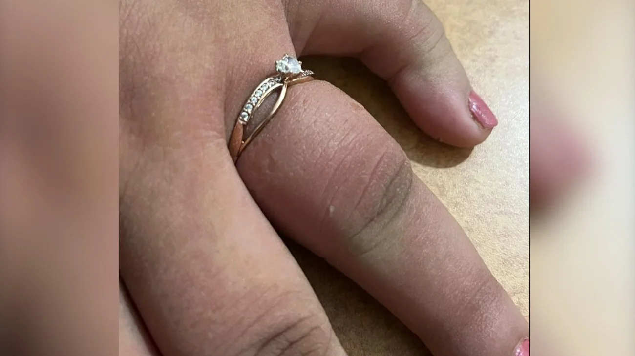 Le proponen matrimonio y anillo se le queda atorado en el dedo
