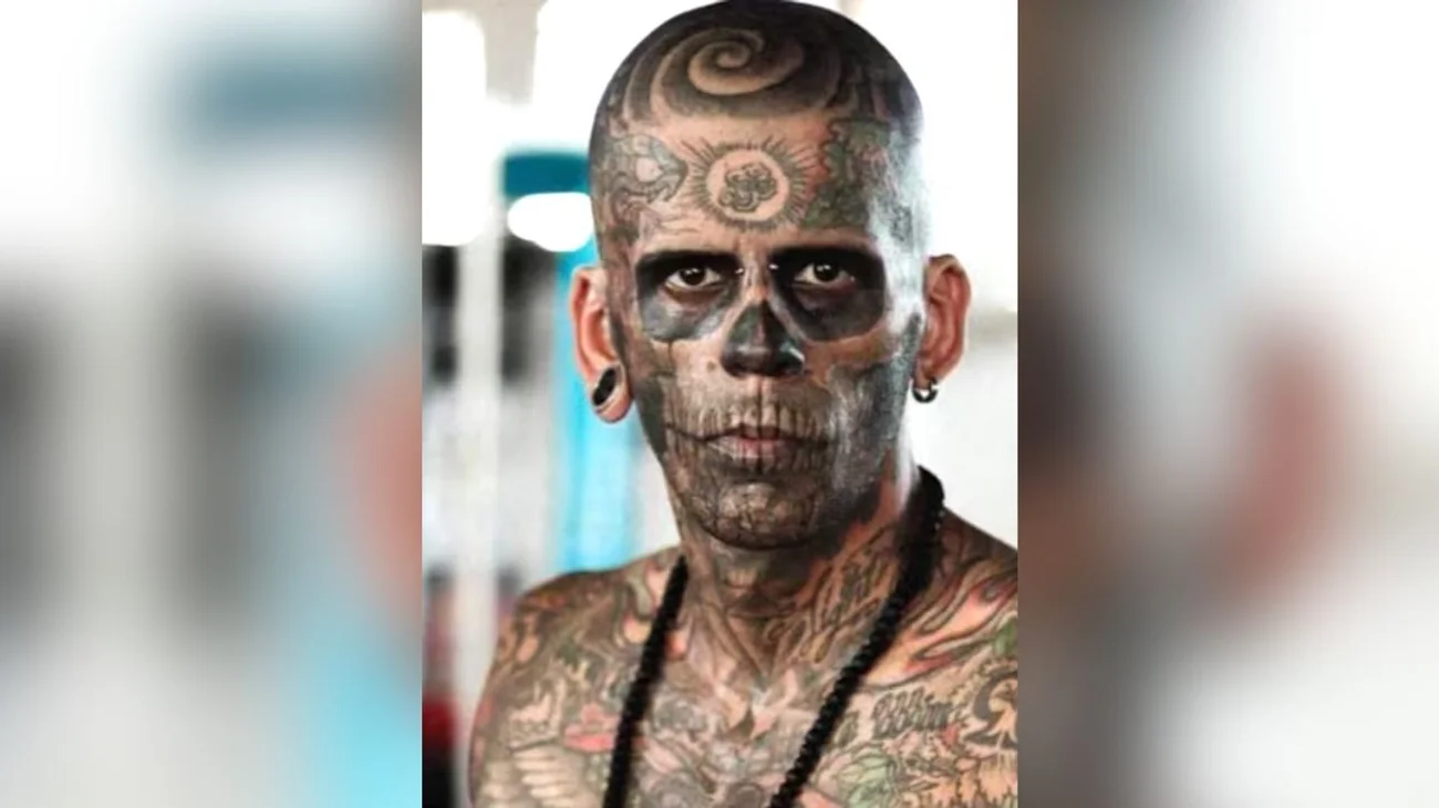 El hombre más tatuado de Brasil se borra tatuajes y así quedó