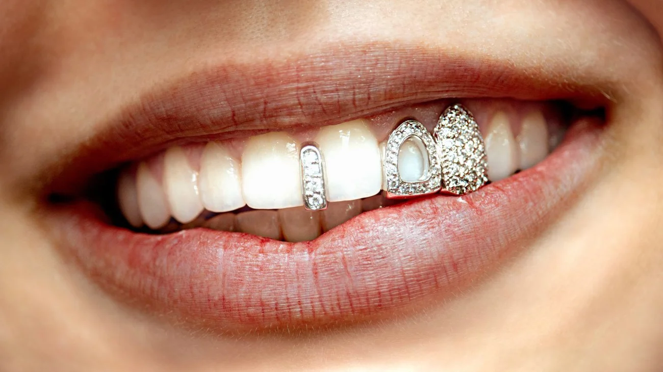 Joyas dentales, lujosa tendencia que brilla entre famosos