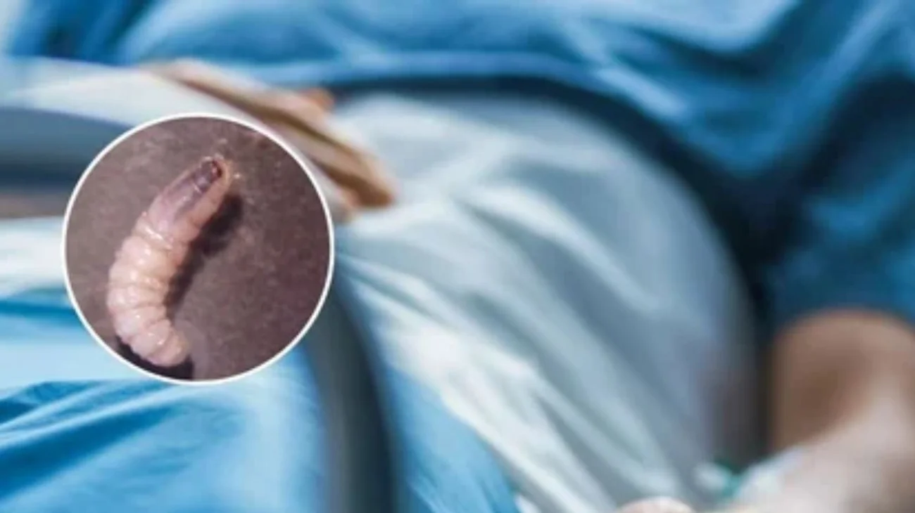 Reporta Nicaragua 117 casos del gusano barrenador desde 2024