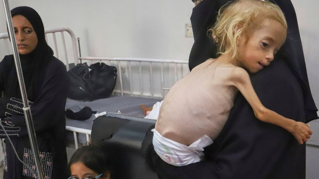 Suben_muertes_por_desnutricion_en_Gaza_Netanyahu_niega_hambruna_d5216b5e9e