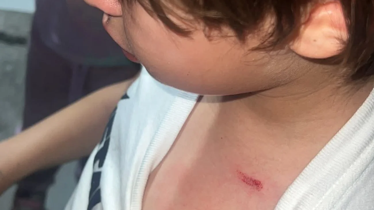 Denuncian agresión a menor con pistola de postas en Saltillo