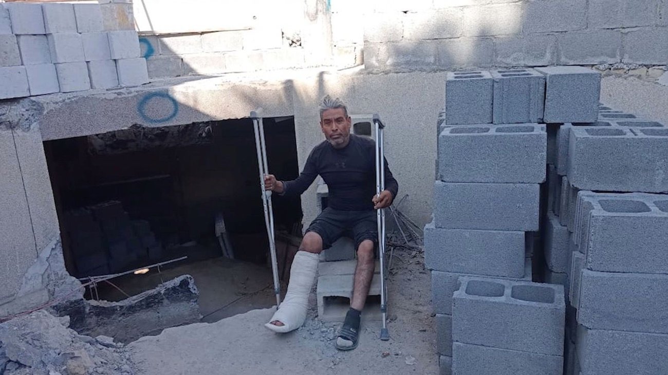 Sufre albañil accidente en obra y empresa lo abandona