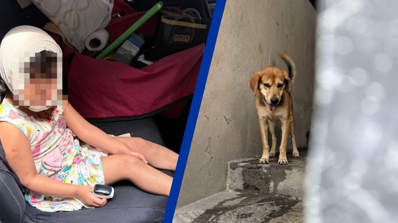 Niña de 3 años resulta lesionada tras ataque de perro