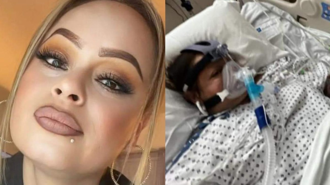 Amputan extremidades a mujer por comer pescado