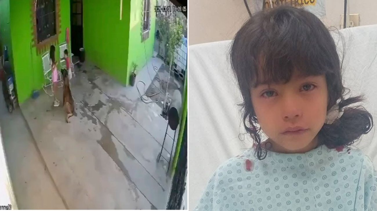 ataque_perro_menor_coahuila_d745e5f7c4