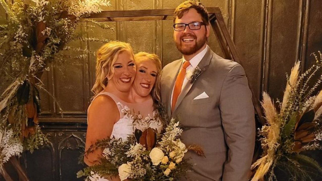 Gemela siamesa se casa con veterano del ejército de EUA