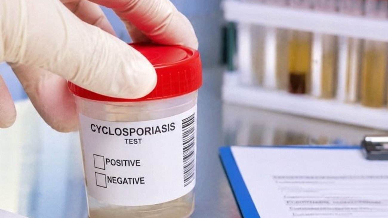 EUA asegura que brote de ciclosporiasis está bajo control