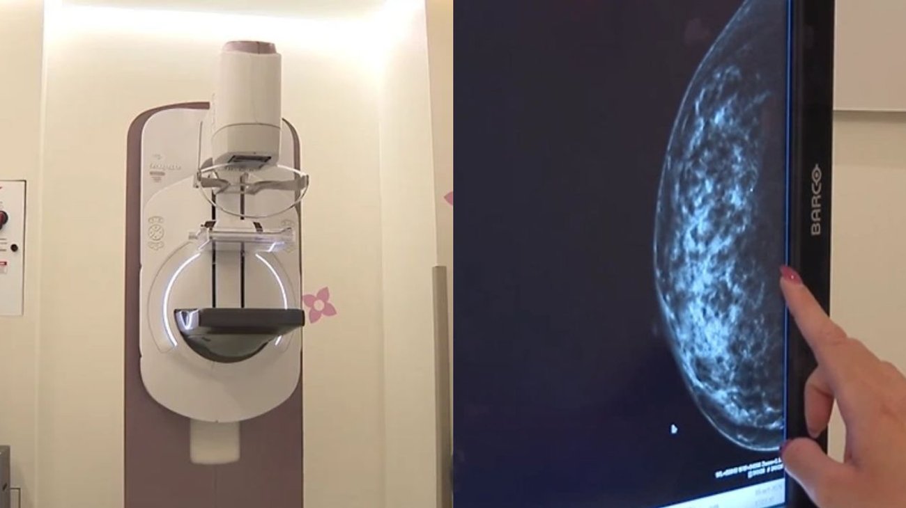 Nuevo León supera tasa nacional de mortalidad por cáncer de mama