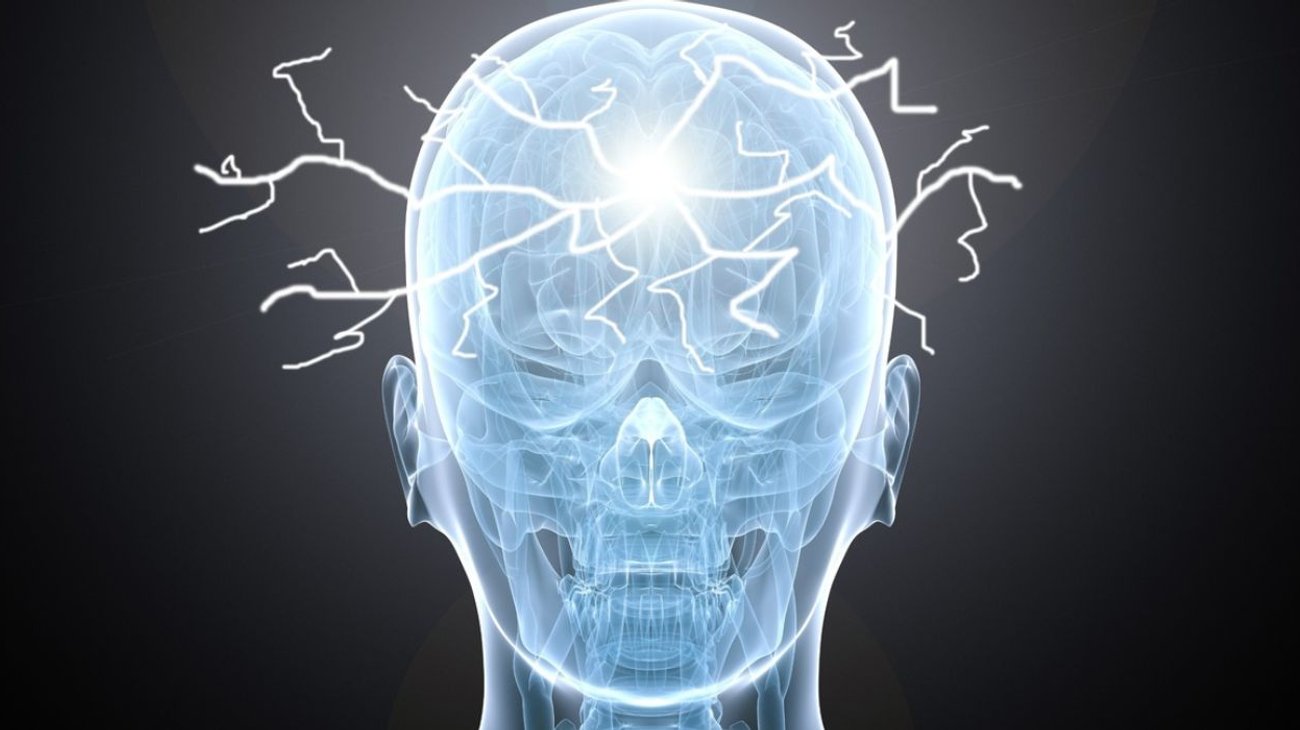 epilepsia_5dd0852221