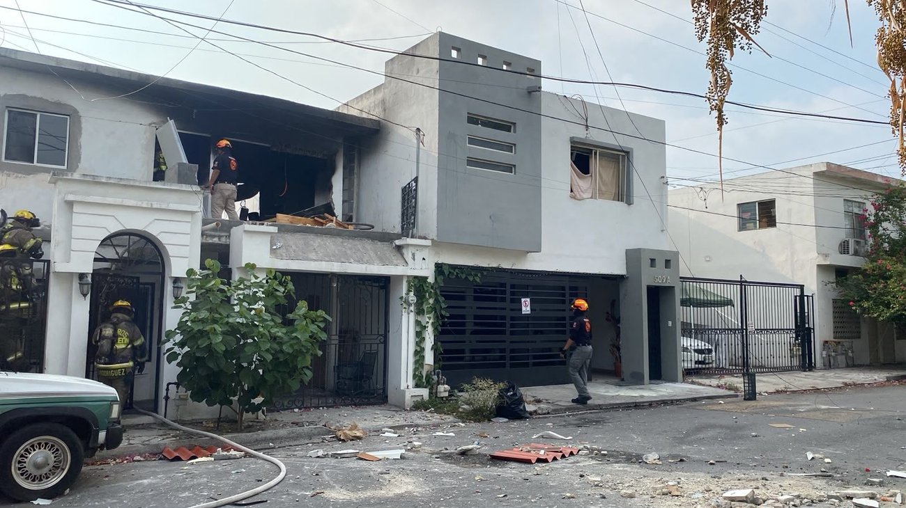 Sigue grave cubano que sufrió quemaduras en casi todo el cuerpo