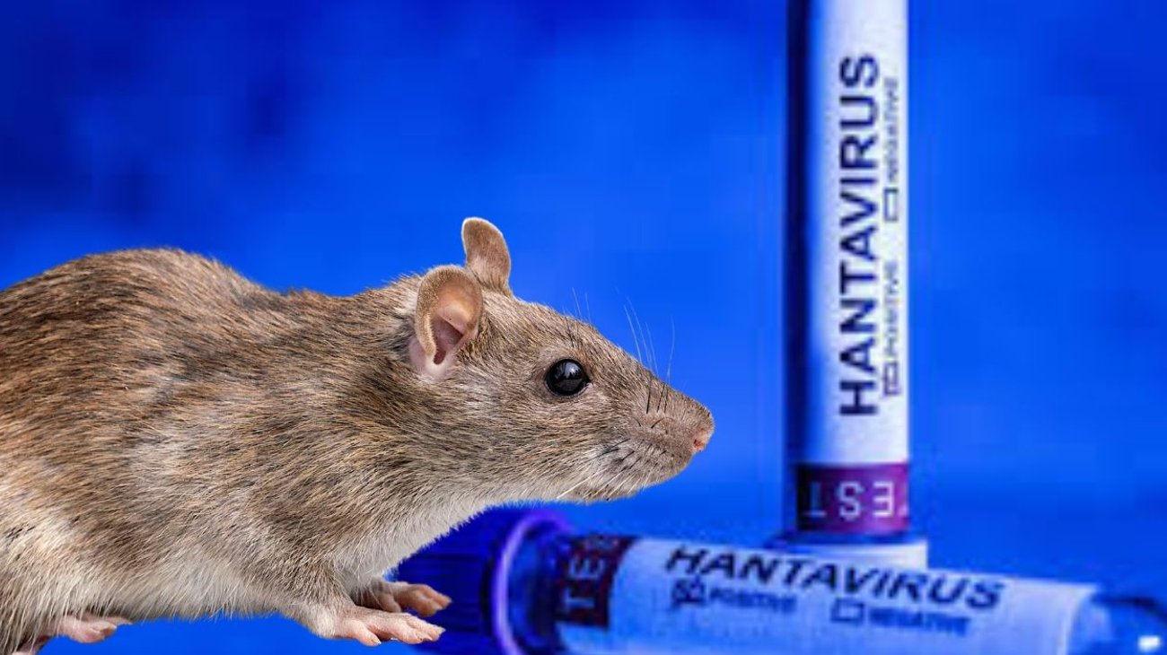 Descartan mutación de hantavirus en paciente francesa