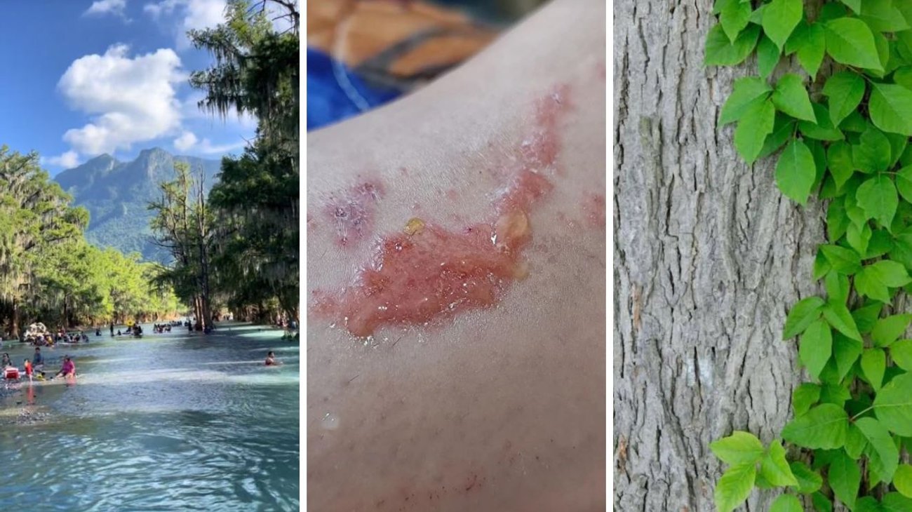 ¡Cuidado con la hiedra venenosa en Río Ramos!