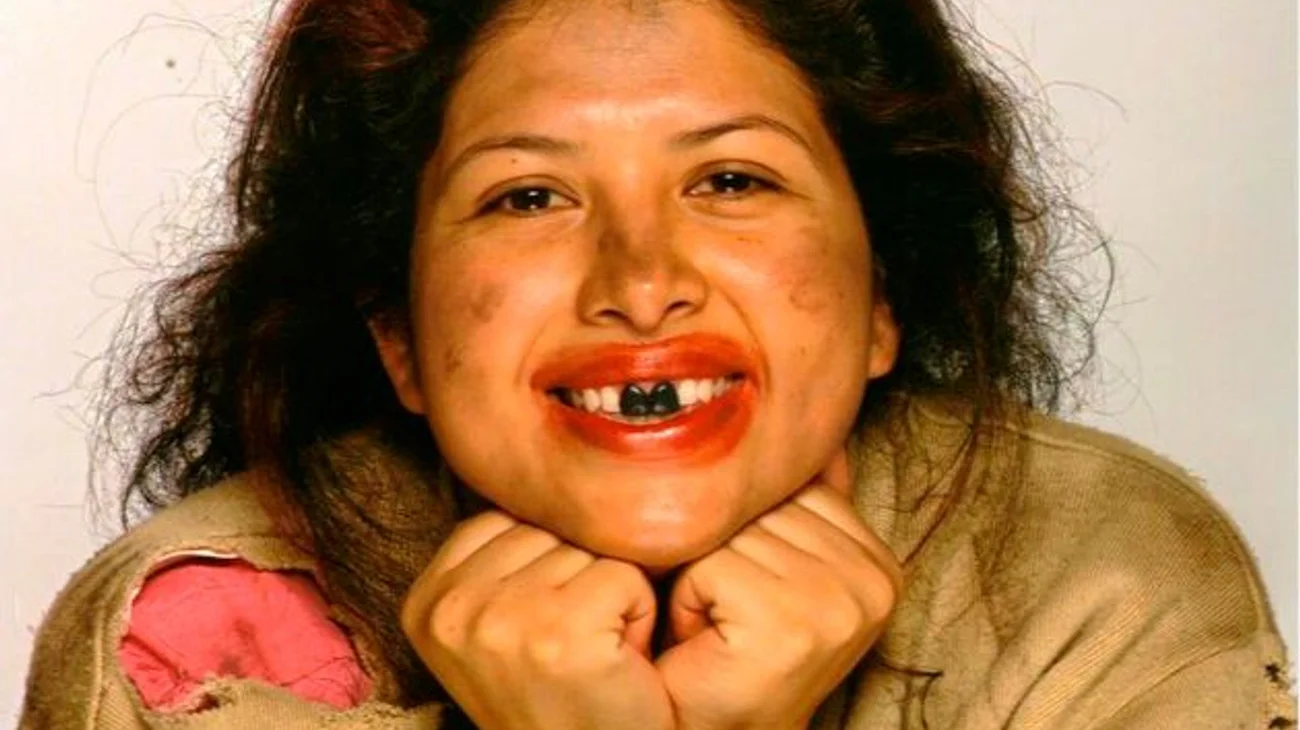 'La Chupitos' tuvo quimioterapias por extraña enfermedad