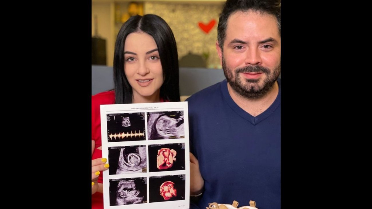 José Eduardo Derbez y su novia esperan a su primer bebé