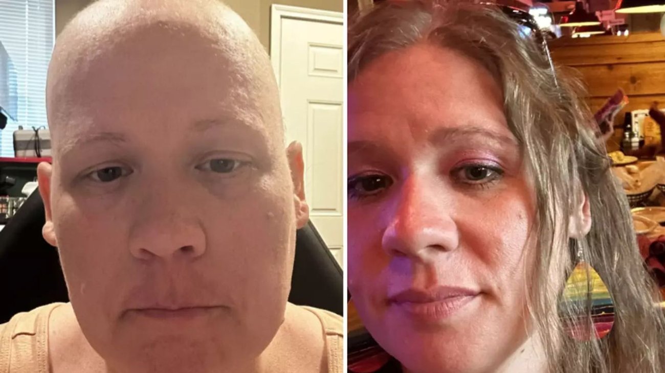 Madre sometida a quimioterapia sin tener cáncer