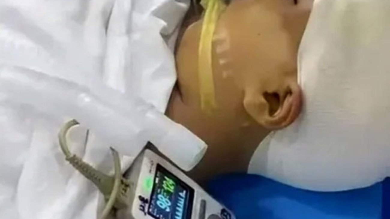 Maestro le pega a niña con una regla; le fractura el cráneo