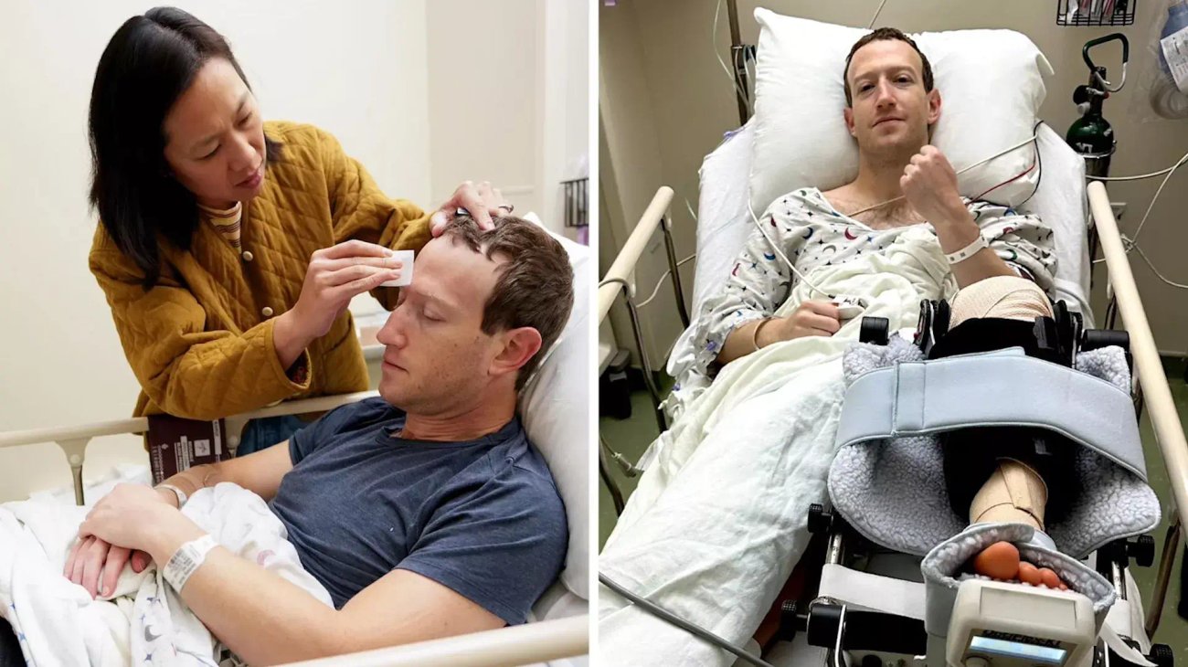 Someten a cirugía a Mark Zuckerberg por lesión