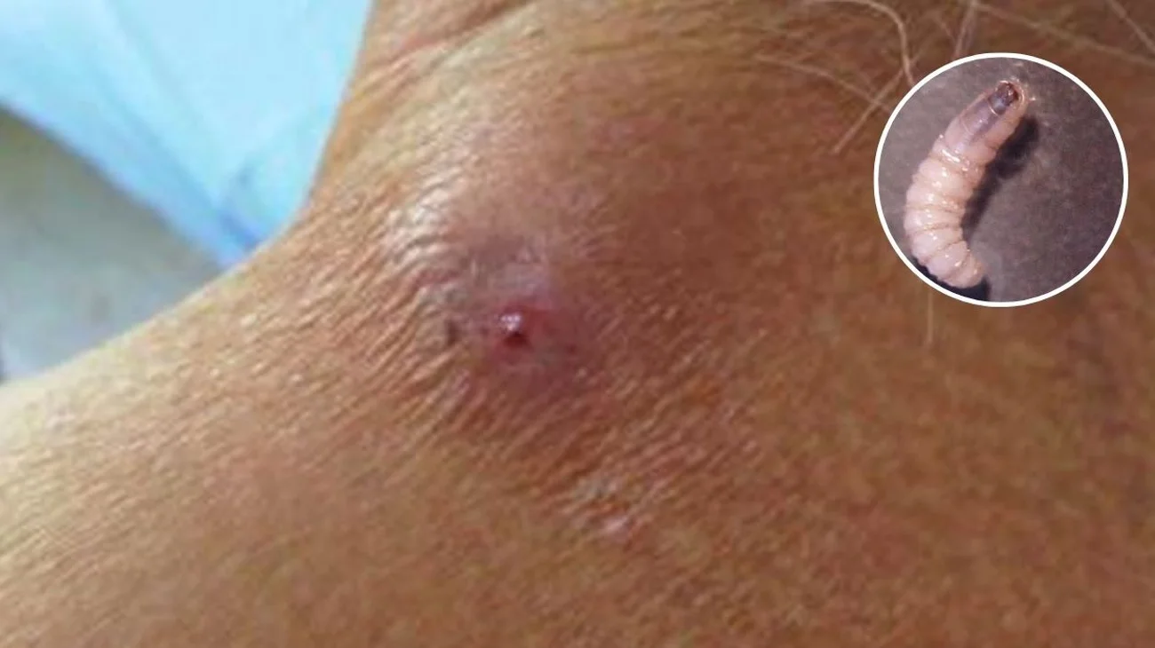 Detectan en Chiapas primer caso de miasis por gusano barrenador