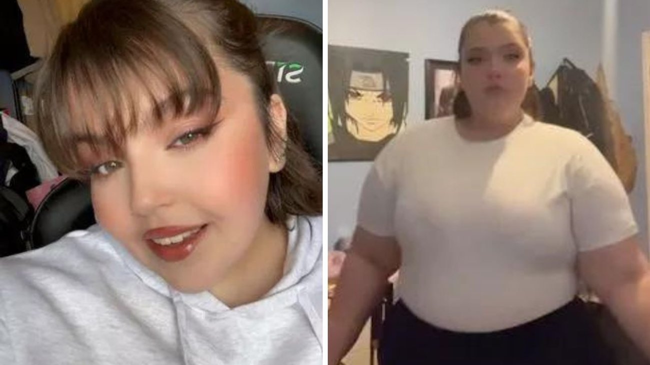 Muere tiktoker de 20 años tras operación de manga gástrica