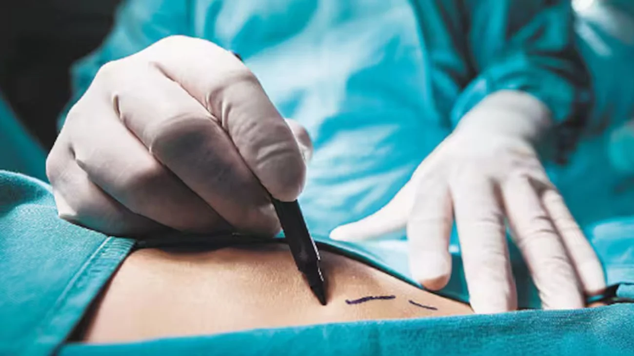 Muere mujer tras someterse a liposucción; investigan a médicos