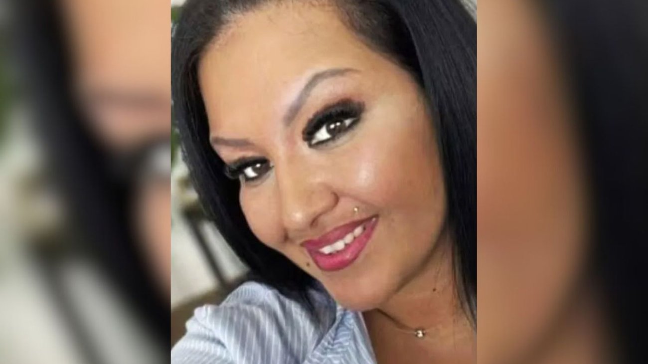 Mujer se rellena los labios y muere tras sufrir una reacción