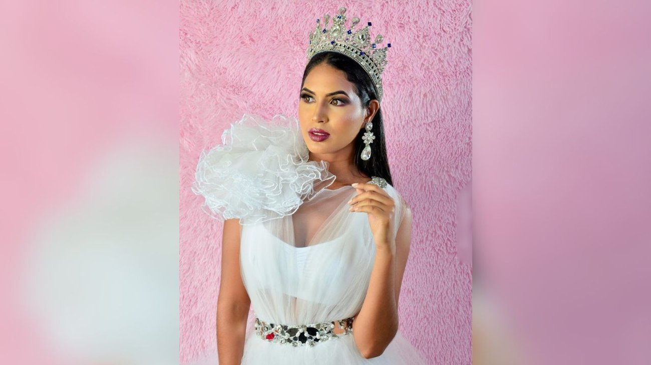 Muere la modelo Wilevis Brito a los 24 años tras cirugía