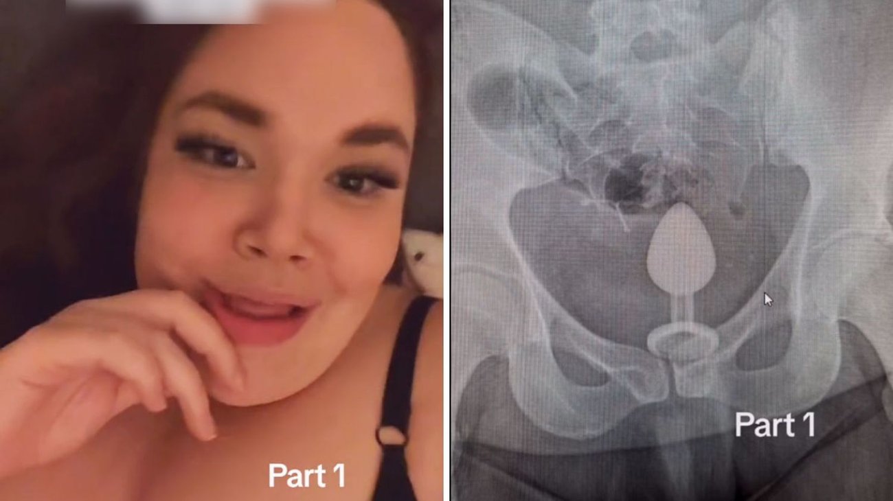 Mujer termina en urgencias tras accidente con juguete sexual