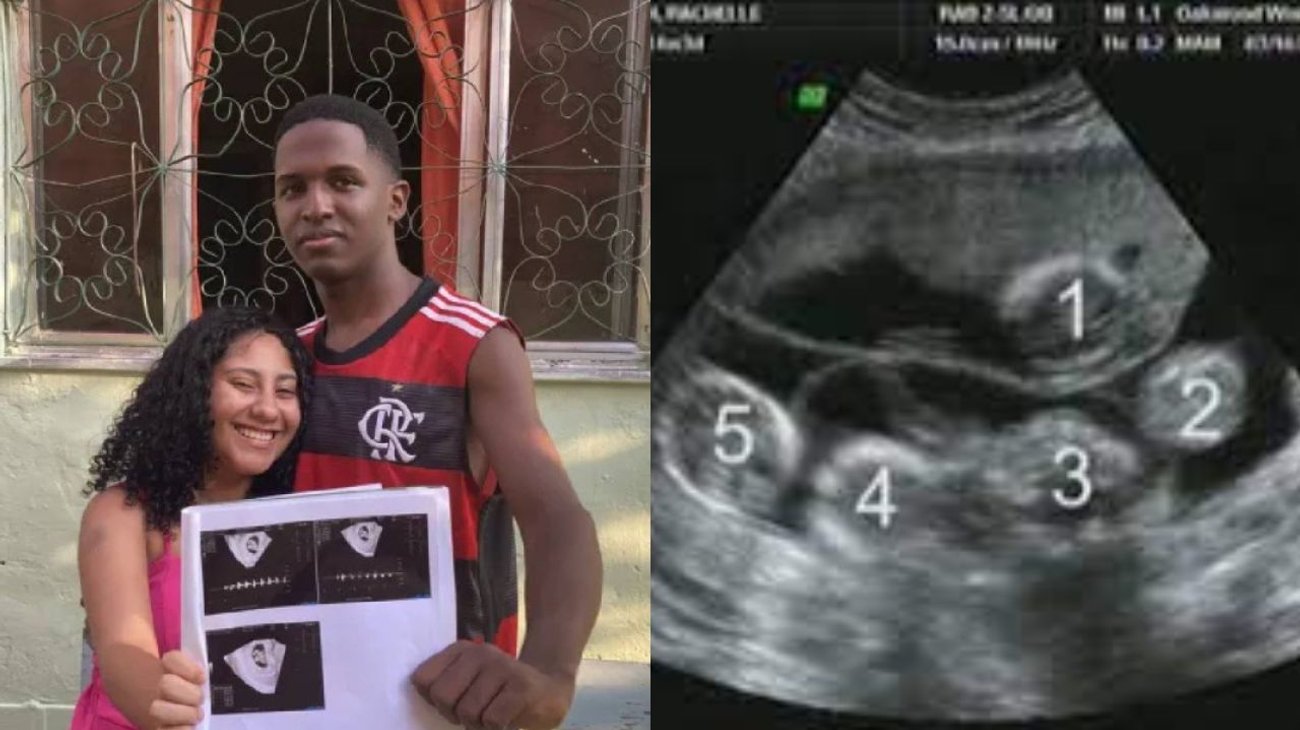 Embarazo de quintillizos sorprende a joven de 18 años