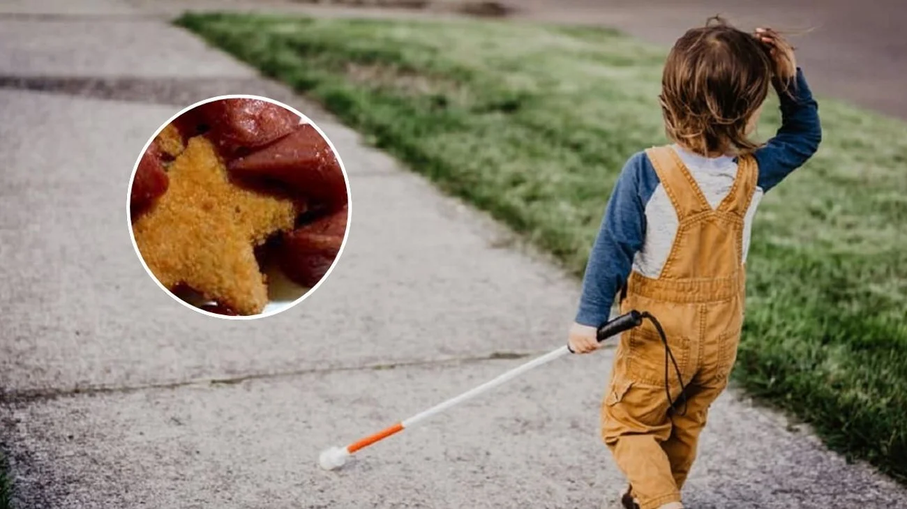 Niño de ocho años queda ciego por comer salchichas y nuggets