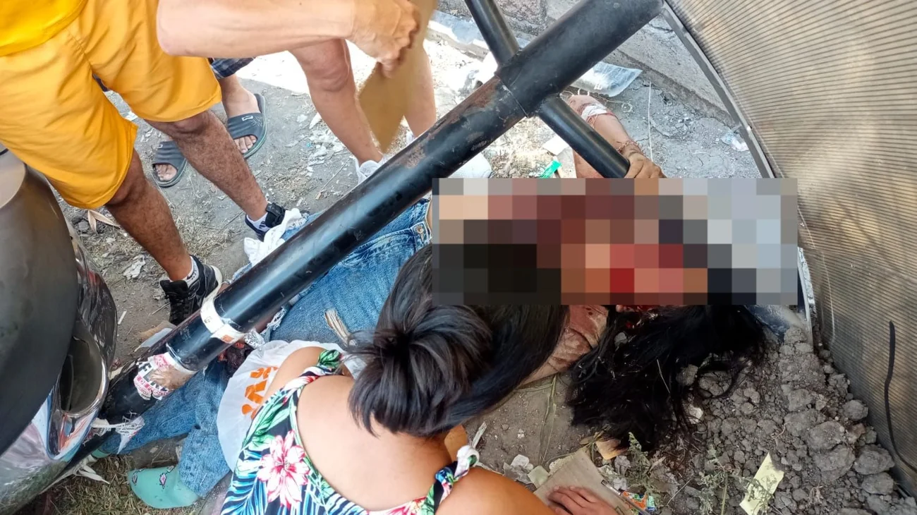 Mujer pierde la pierna tras ser atropellada en Juárez