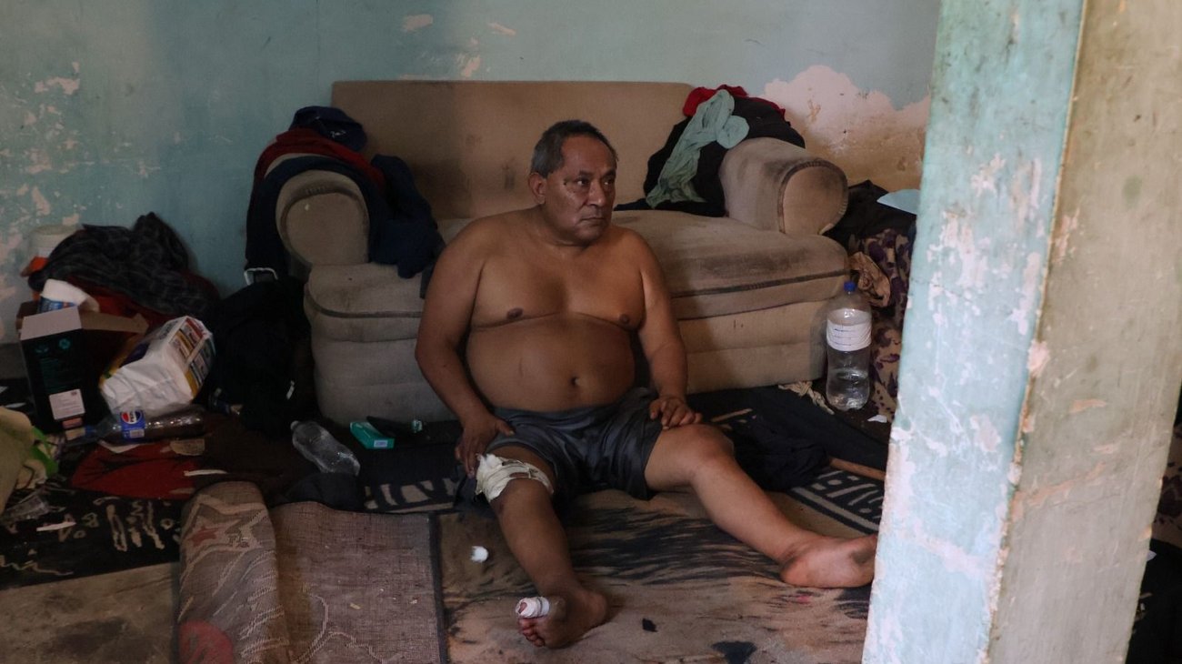 rescate_dif_nl_y_pcnl_1_d949e11bcd