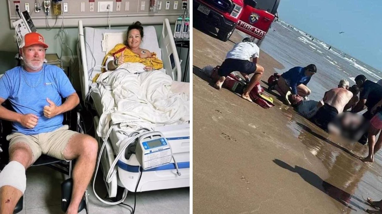 'Mi pierna está casi destruida': Mujer atacada por tiburón