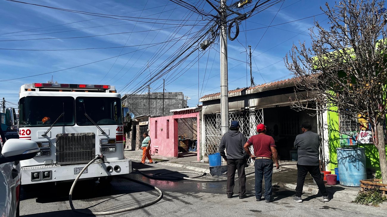 Persona de la tercera edad termina con quemaduras tras incendio