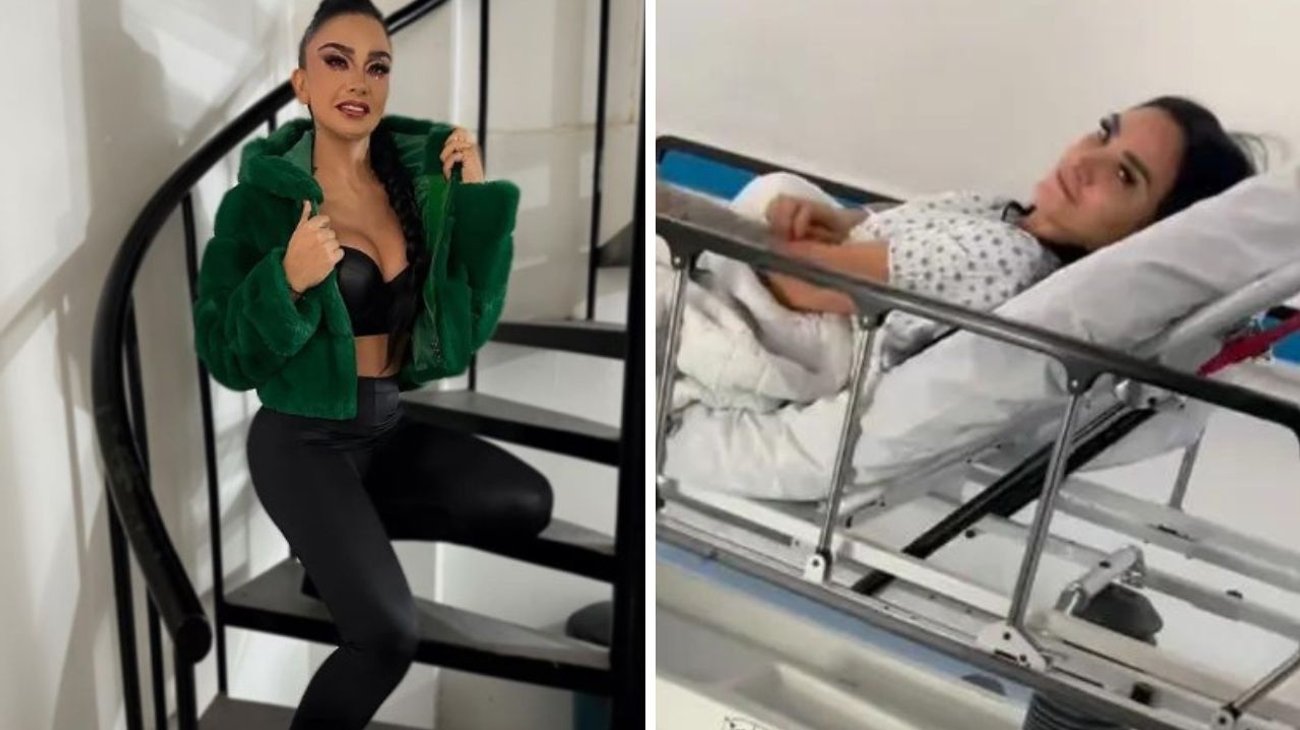 Wanders Lover sufre amputación por inyección de polímeros